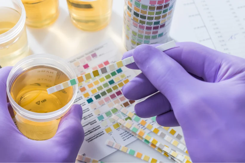 a person holding a test strip